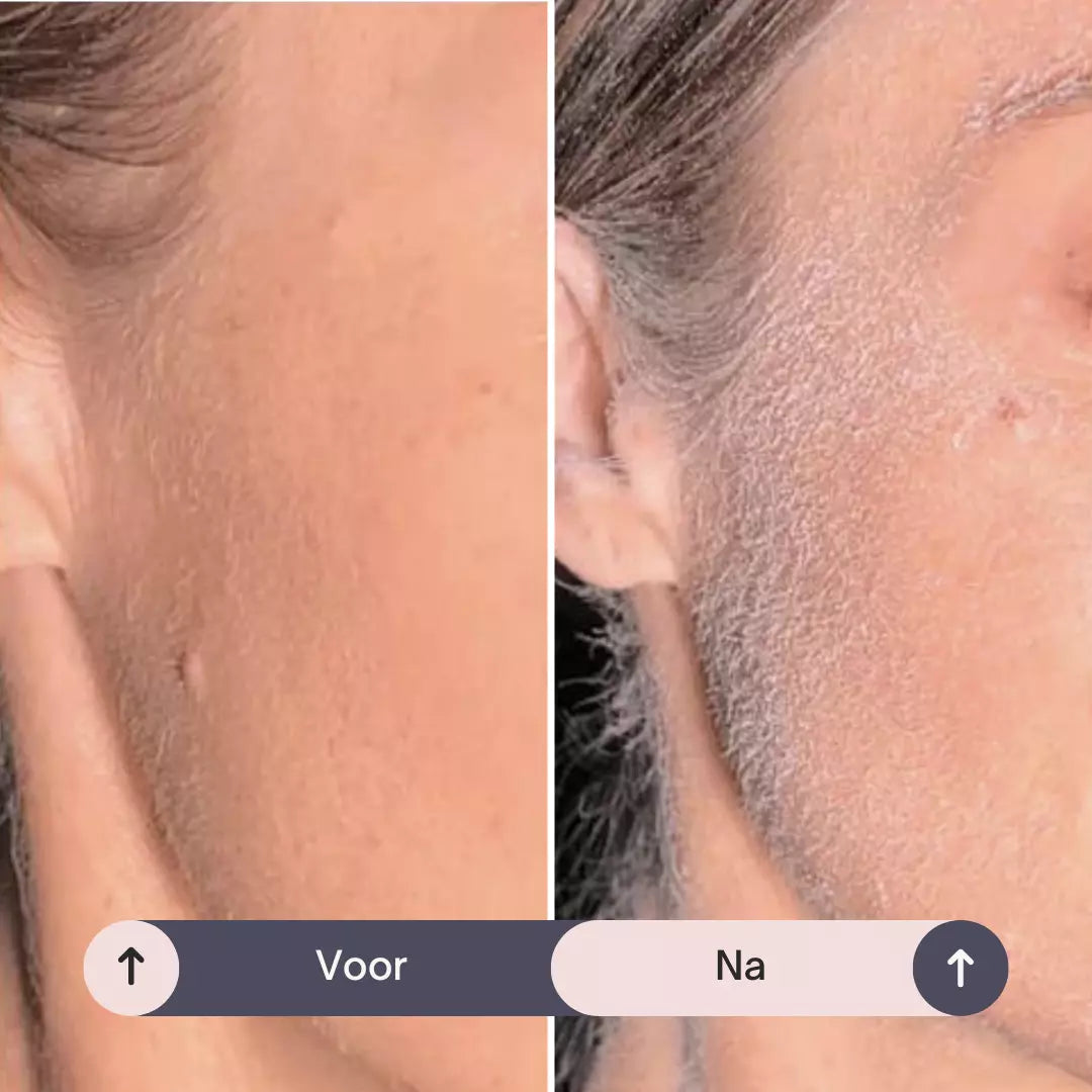 FlawlessFace Dermaplaning Set | Transformeer Je Huid met Perfecte Precisie