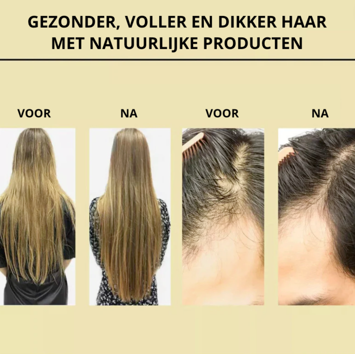 NaturGro Haargroei-olie | Voor Natuurlijk Sterk en Vol Haar